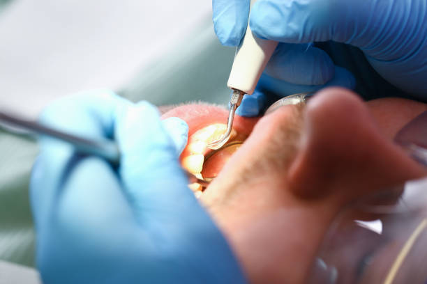 Best Emergency Dental Services for Seniors in Texkana, AR