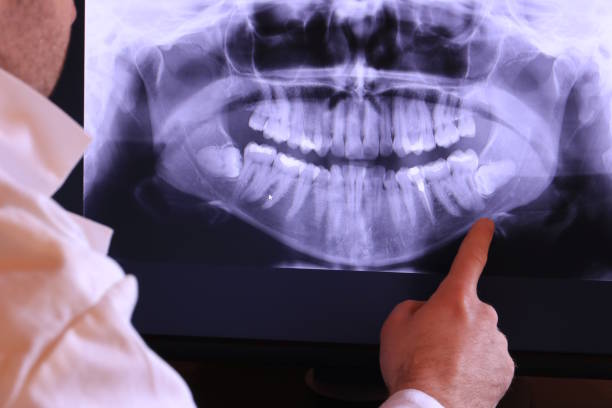 Best Emergency Dentist for Lost Fillings or Crowns in Texkana, AR