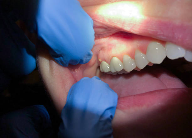 Best Broken or Cracked Tooth Emergency Dentist in Texkana, AR